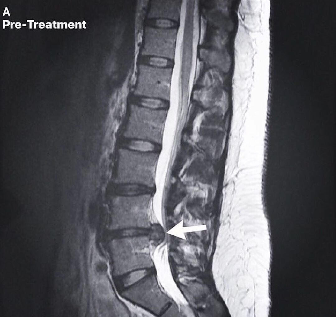 Dr. Ryan Hetland | Chiropractor | Inver Grove Heights, MN