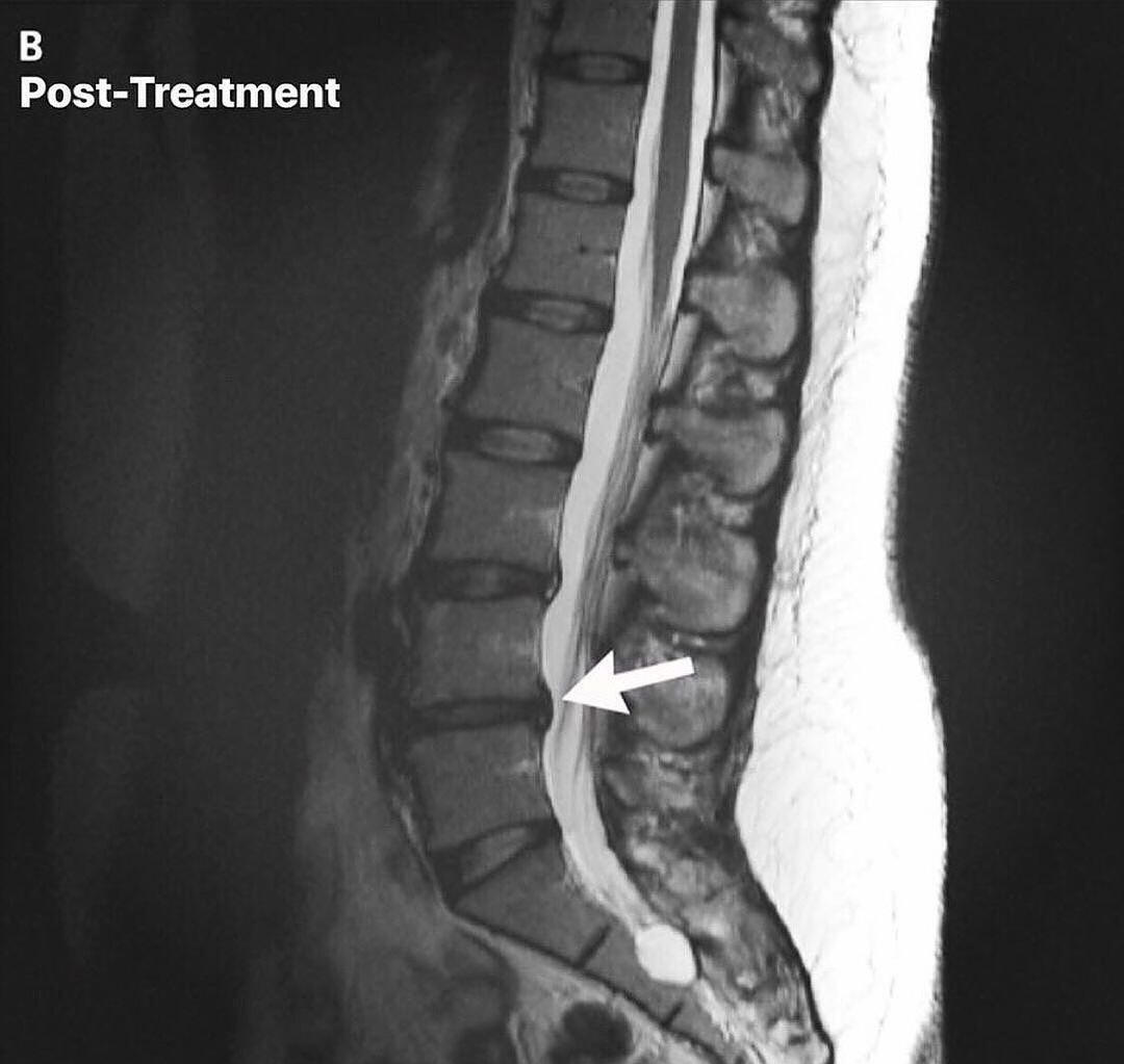 Dr. Ryan Hetland | Chiropractor | Inver Grove Heights, MN